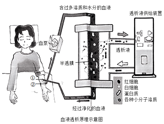 肾病治疗革新，最新方法取代透析之路